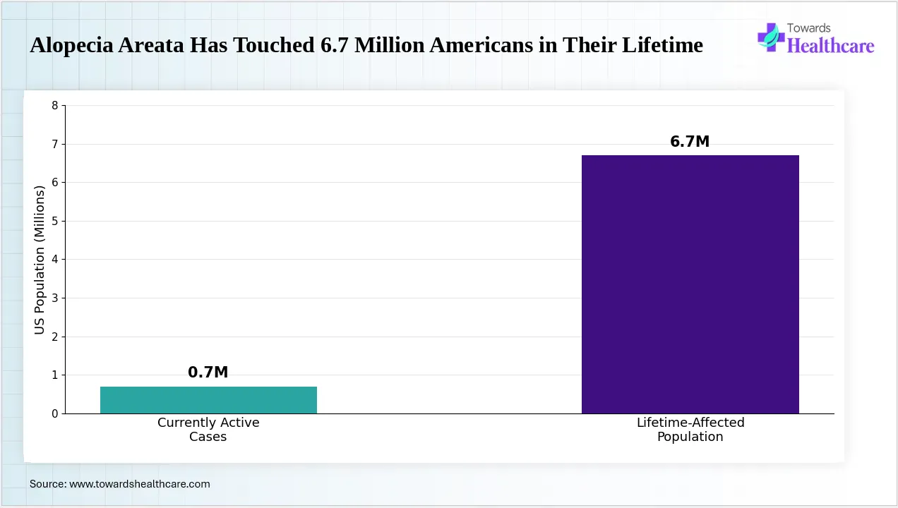 Millions of Americans experience alopecia areata at some point in life