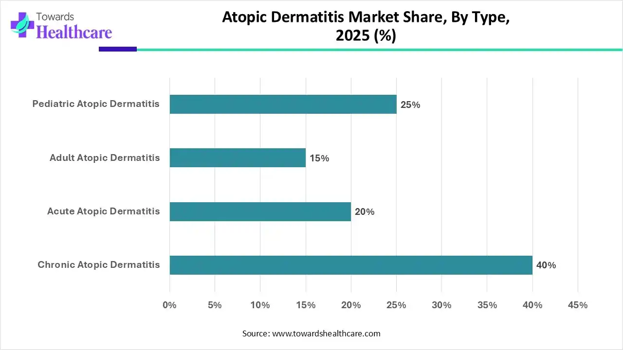 Atopic Dermatitis Market Share, By Type, 2025 (%) Atopic Dermatitis Market Share, By Type, 2025 (%)
