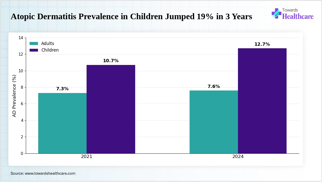 Atopic dermatitis prevalence in children has risen sharply in recent years