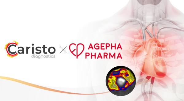 Cardio Diagnostics Teams Up with AGEPHA Pharma to Advance CHD Treatment with LODOCO® Cardio Diagnostics Teams Up with AGEPHA Pharma to Advance CHD Treatment with LODOCO®