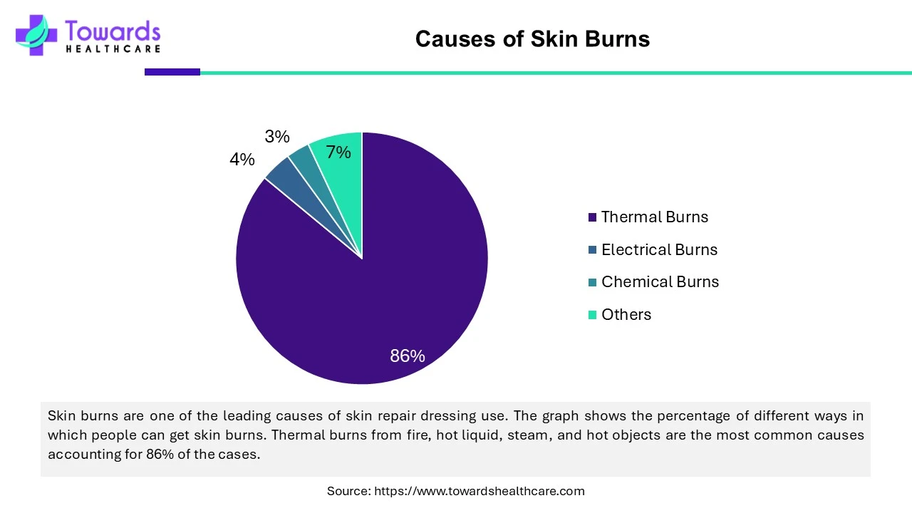 Causes of Skin Burns Causes of Skin Burns