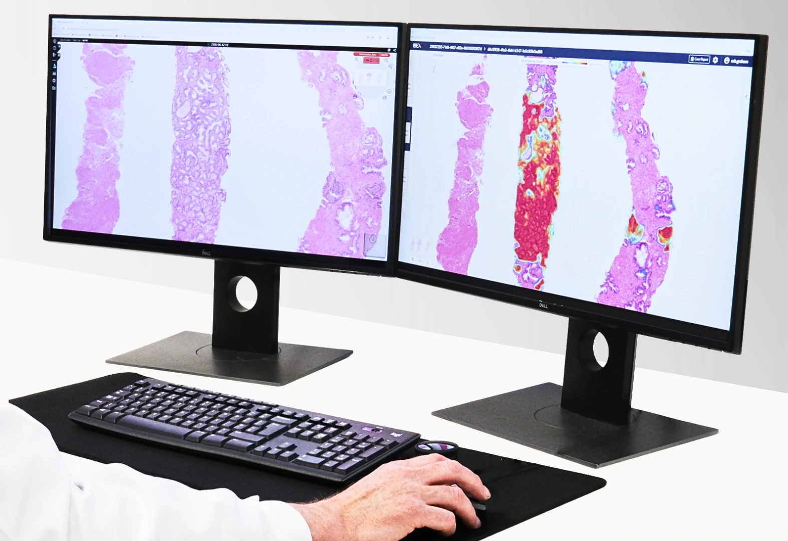 FUJIFILM Healthcare Europe and Ibex Partner to Transform Cancer Diagnostics with AI FUJIFILM Healthcare Europe and Ibex Partner to Transform Cancer Diagnostics with AI