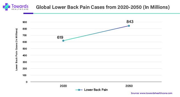 Global Lower Back Pain Cases from 2020 - 2050 (In Millions) Global Lower Back Pain Cases from 2020 - 2050 (In Millions)