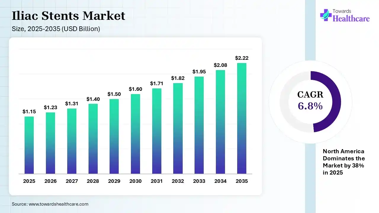 Iliac Stents Market Size is USD 1.23 Billion in 2026.