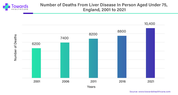 Number of Deaths from Liver Disease in Person Aged Under 75, England, 2001 to 2021 Number of Deaths from Liver Disease in Person Aged Under 75, England, 2001 to 2021