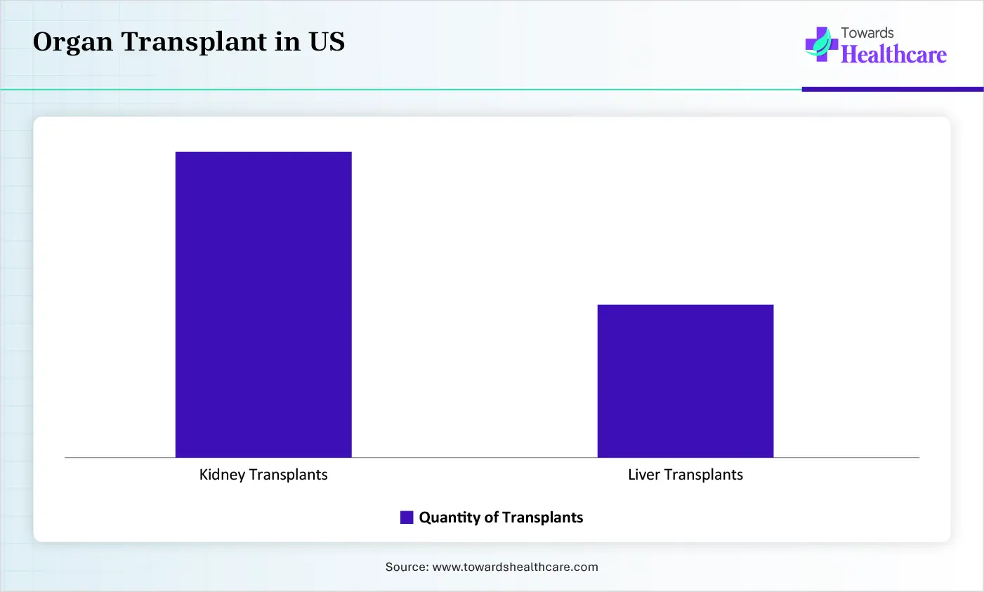Organ Transplant in US