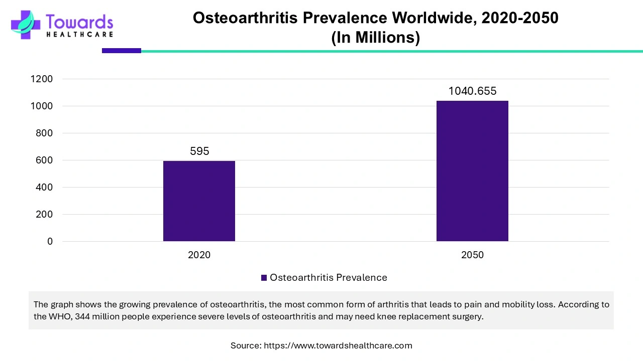 Osteoarthritis Prevalence Worldwide, 2020 - 2050 (In Millions) Osteoarthritis Prevalence Worldwide, 2020 - 2050 (In Millions)