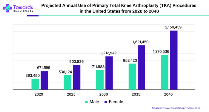 Projected Annual Use of Primary Total Knee Arthroplasty (TKA) Procedures in the United States from 2020 to 2040 Projected Annual Use of Primary Total Knee Arthroplasty (TKA) Procedures in the United States from 2020 to 2040