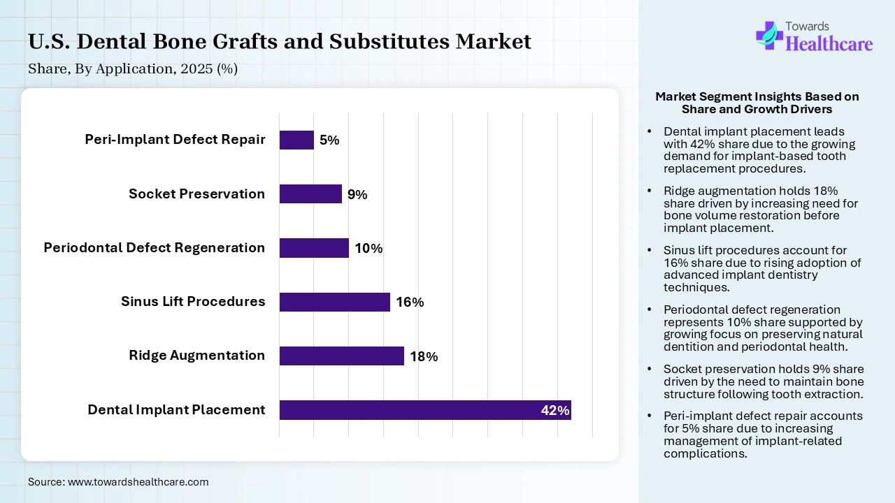 U.S. Dental Bone Grafts and Substitutes Market Share, By Application, 2025 (%) U.S. Dental Bone Grafts and Substitutes Market By Application, (Dental Implant Placement) Segment Dominates by 42% in 2025.
