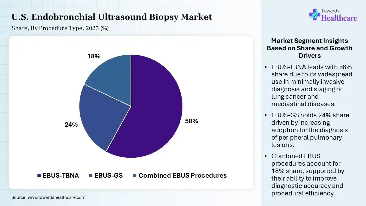 U.S. Endobronchial Ultrasound Biopsy Market By Procedure Type, (EBUS-TBNA) Segment Dominates by 58% in 2025.