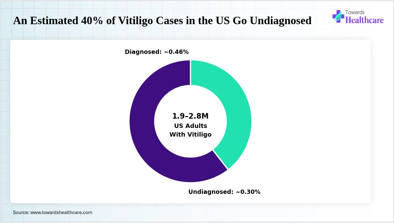 A large share of vitiligo cases in the US remain undiagnosed